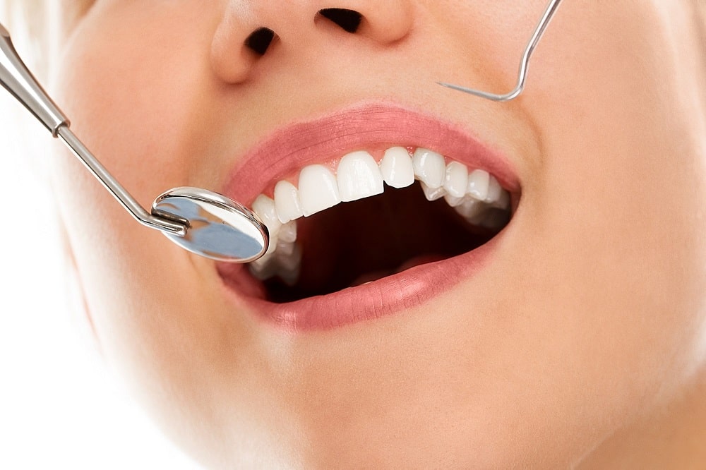 روکش دندان چیست و چه کاربردی دارد؟