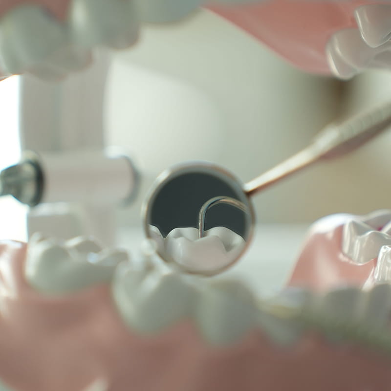 افزایش طول تاج دندان (Crown Lengthening)