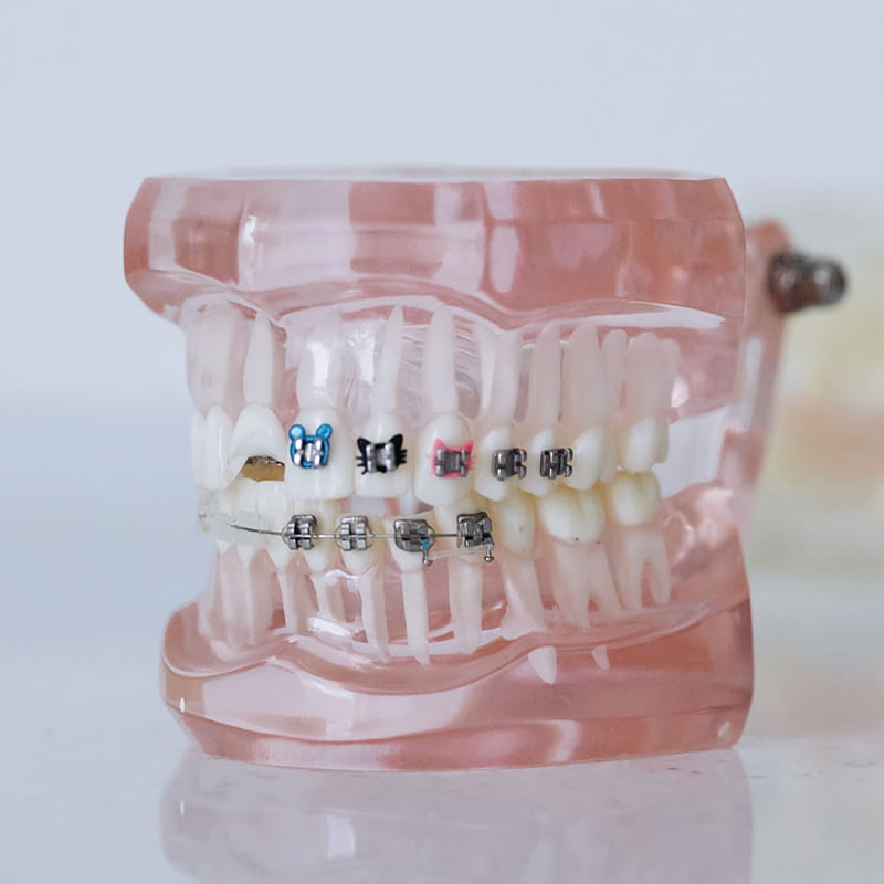 درمان اختلالات مفصل فک (TMJ / TMD)